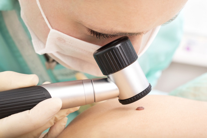 Best Skin Cancer Clinic